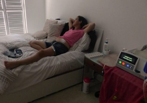 Alison Lawrence lying on her bed during her time on dialysis