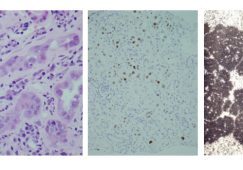 Images of the BK virus