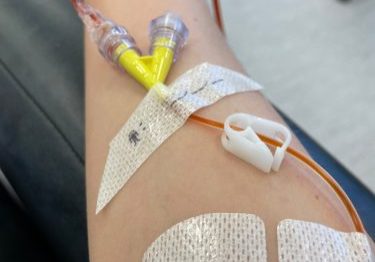 Image of a forearm with canula inserted to draw blood