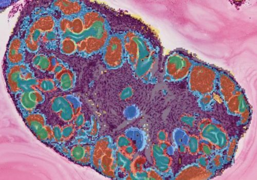 An image of an early kidney which is mainly purple in colour with dots of red and blue.