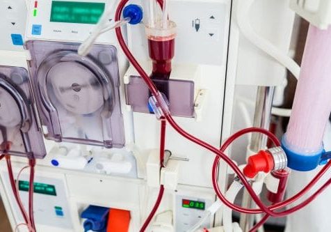 Dialysis device with rotating pumps. Closeup view.