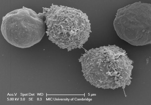 Black and white image of CMV cells