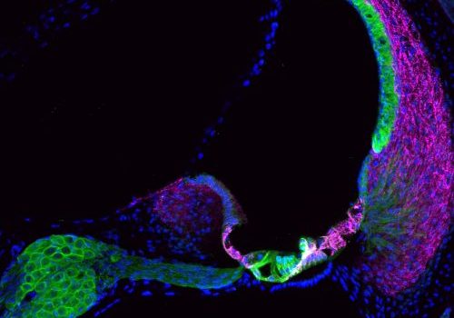 An cross-section image of vivid coloured cells that are green and others that are a pinky purple colour, the cells are grouped together and shaped in a crescent moon shape.