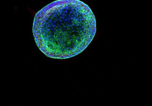 A black background with a jellyfish like shape colour blue and green.