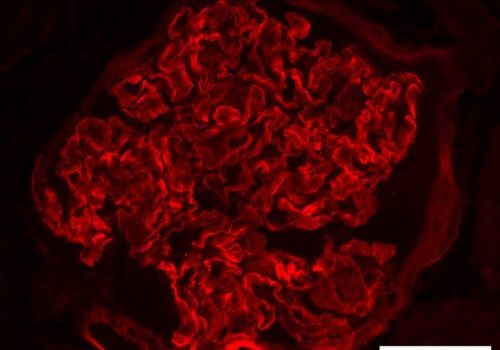 Red pattern, that is almost brain like in shape, which is the stain of collegen.