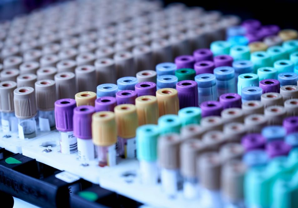 testalize-me-0jE8ynV4mis-unsplash Vacutainer tubes with blood.