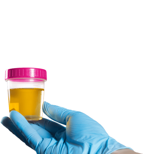 header_hand-urine